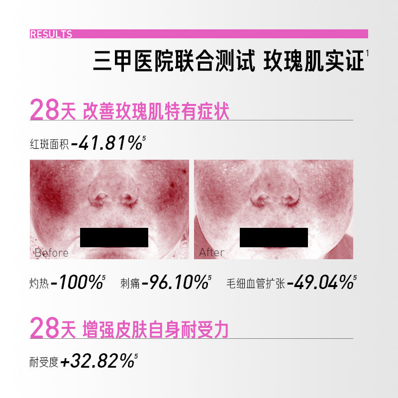 AR Moisturizer for Rosacare